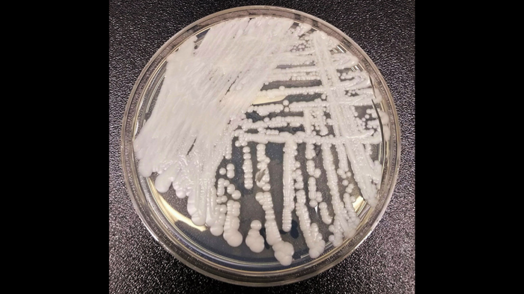 A growing white fungus is shown in a petri dish.