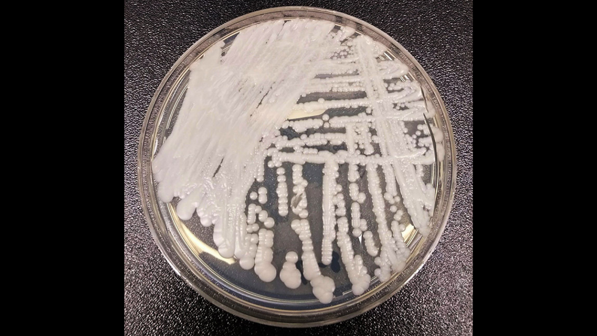 W.Va. Sees First Cases Of Drug-Resistant Fungi