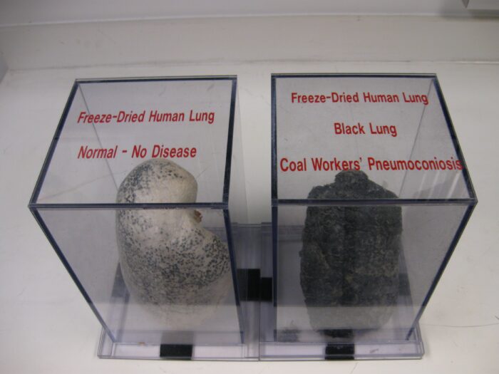Two cases are shown with freeze-dried human lungs. The case on the left features a normal looking lung that looks mostly white. The case on the right features a lung that is almost black from black lung disease.
