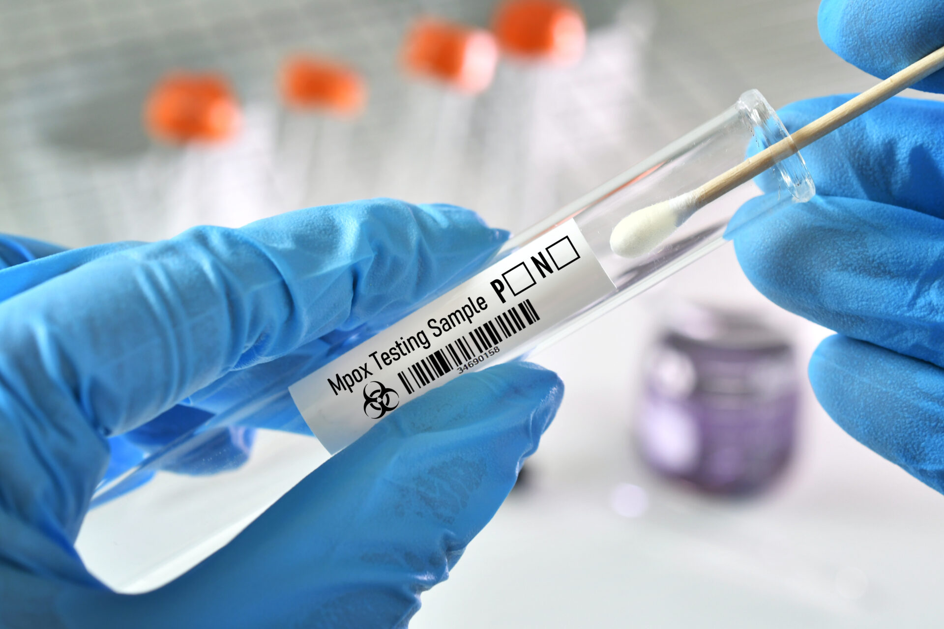 Risk Low From New Kind Of Mpox Showing Up In U.S.