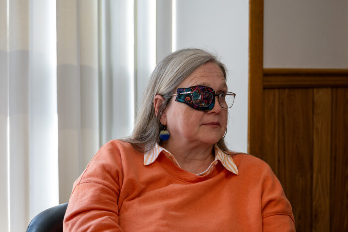 Woman in an orange sweater and an eye patch looks off camera