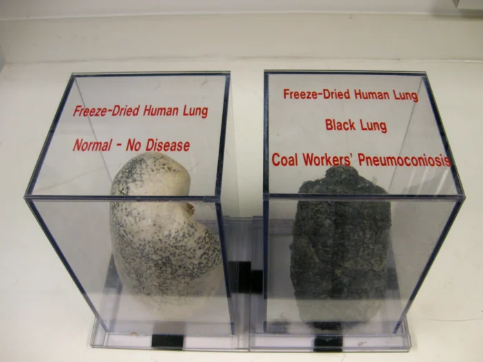 A side-by-side display of a healthy human lung versus a human lung with black lung disease. The healthy lung looks almost white, while the lung with black lung disease is completely black.